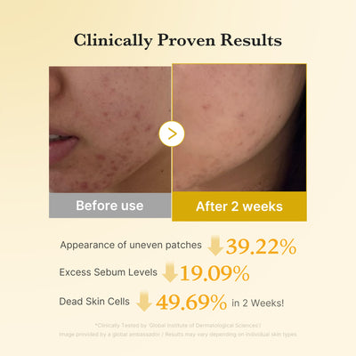 Medicube Kojic Acid Turmeric — Underarm & Body Brightening Pads