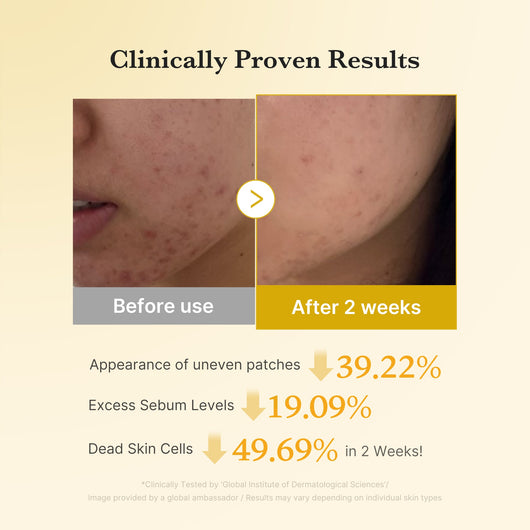 Medicube Kojic Acid Turmeric — Underarm & Body Brightening Pads