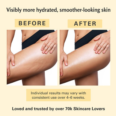 Visibly more hydrated, smoother-looking skin — before and after, results may vary over 4-6 weeks