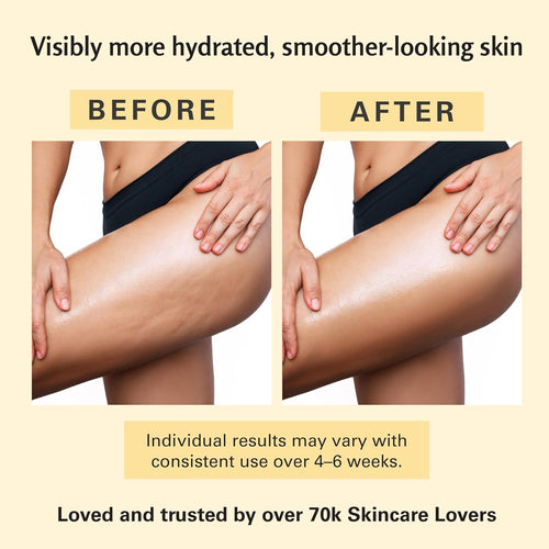 Anti-Cellulite Massage Oil — Collagen + Stem Cell Body Oil (8 fl oz)